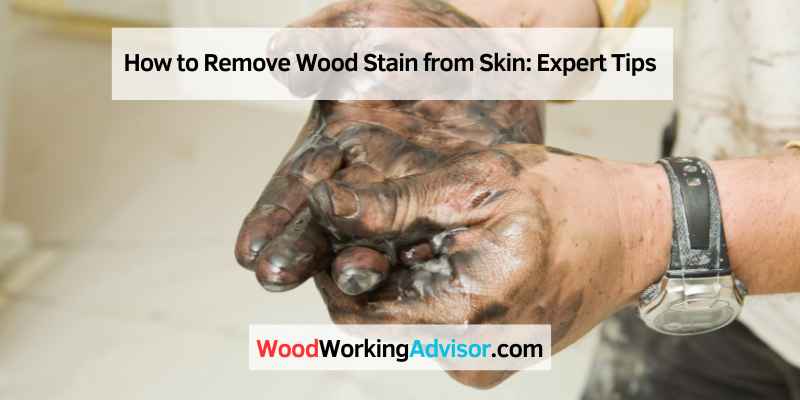 How to Remove Wood Stain from Skin