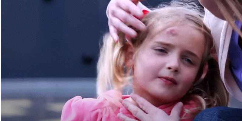 Baby Fell And Hit Head on Hardwood Floor