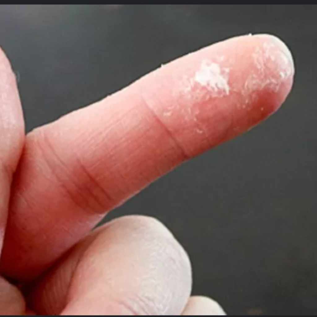 How to Safely Remove Accidentally Applied Super Glue